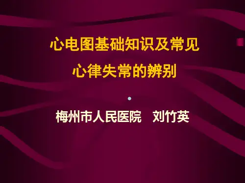 心电图基础知识及常见
