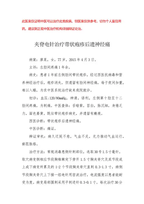 中医医案——带状疱疹后遗神经痛