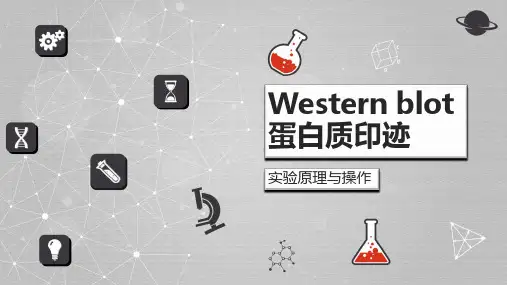 蛋白质印迹技术原理与操作流程Western blot