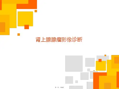 肾上腺腺瘤影像诊断