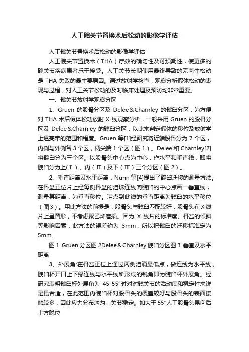 人工髋关节置换术后松动的影像学评估