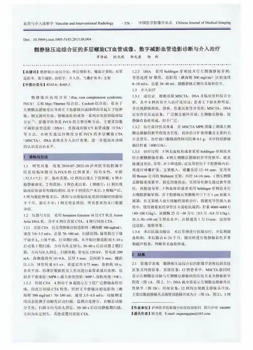 髂静脉压迫综合征的多层螺旋CT血管成像、数字减影血管造影诊断与介入治疗