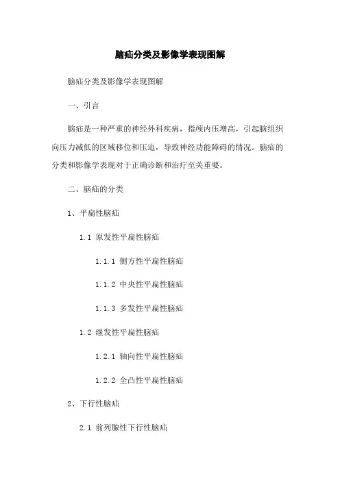 脑疝分类及影像学表现图解
