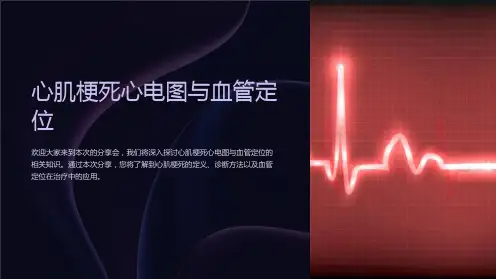 心肌梗死心电图与血管定位