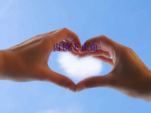 内镜下止血课件