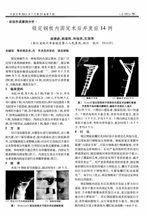 锁定钢板内固定术后并发症14例
