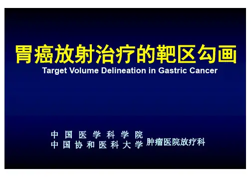 胃癌的靶区勾画