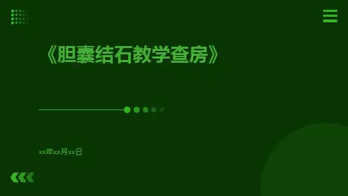 胆囊结石教学查房