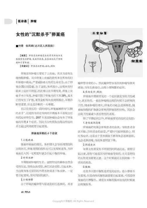 26412134_女性的“沉默杀手”卵巢癌
