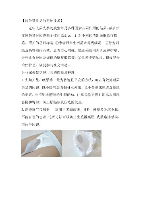 老年健康服务《内容2.3.2-尿失禁的照护》