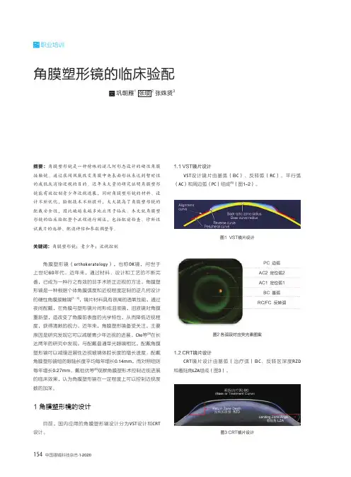 角膜塑形镜的临床验配