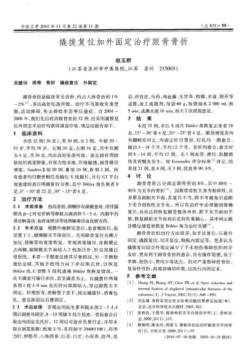 撬拨复位加外固定治疗跟骨骨折