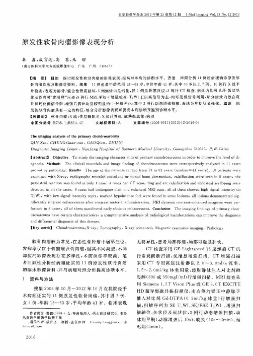 原发性软骨肉瘤影像表现分析