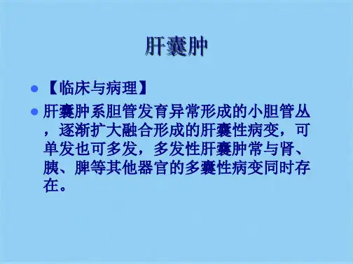 肝囊肿影像诊断(共5张PPT)