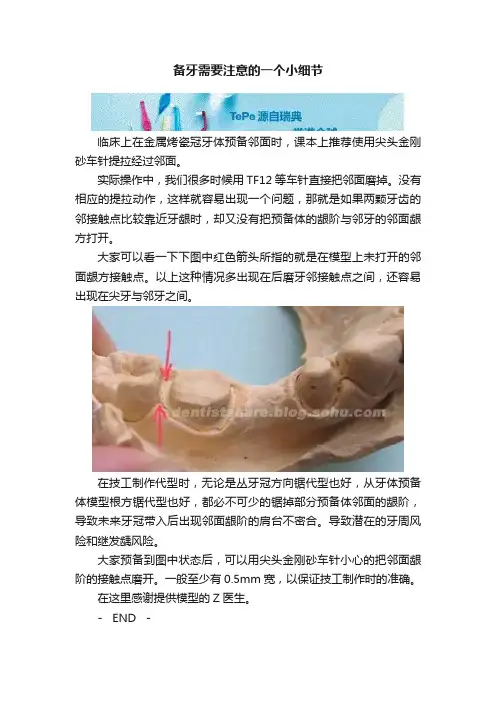 备牙需要注意的一个小细节