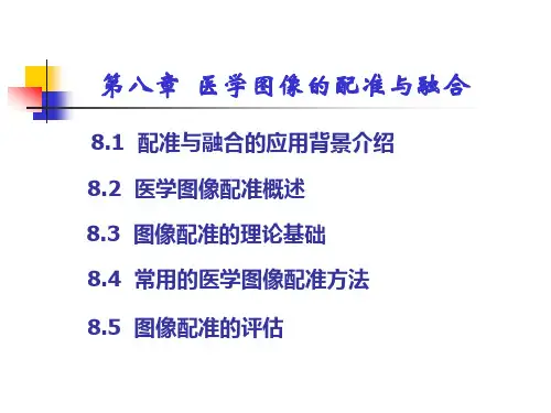 医学图像的配准与融合.ppt