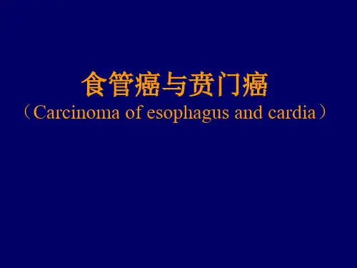 食管癌讲稿PPT课件