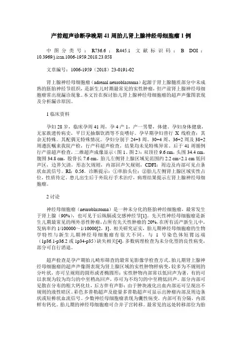 产前超声诊断孕晚期41周胎儿肾上腺神经母细胞瘤1例