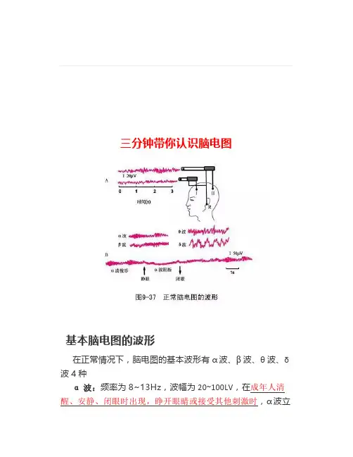 三分钟带你认识脑电图