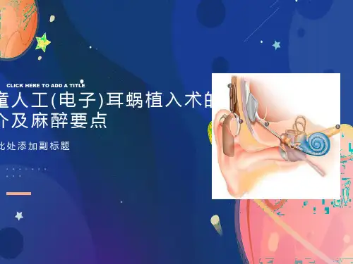 儿童人工耳蜗植入术的简介及麻醉要点