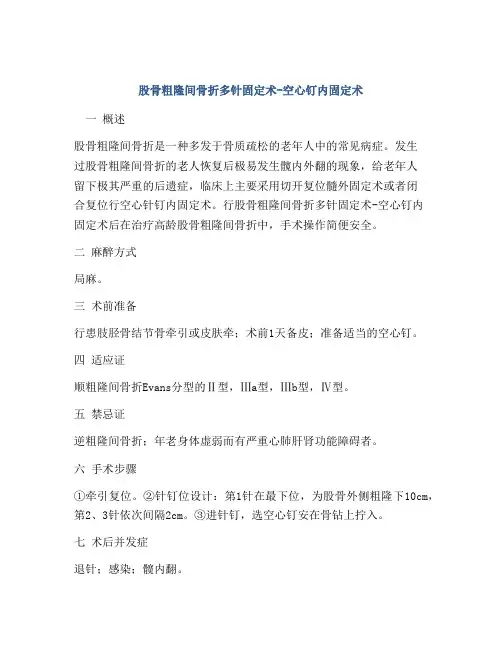 股骨粗隆间骨折多针固定术-空心钉内固定术