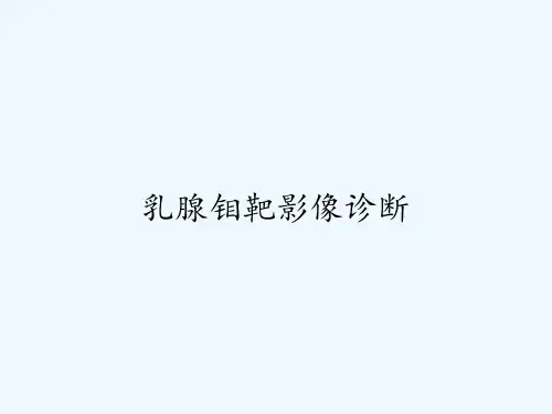 乳腺钼靶影像诊断-PPT