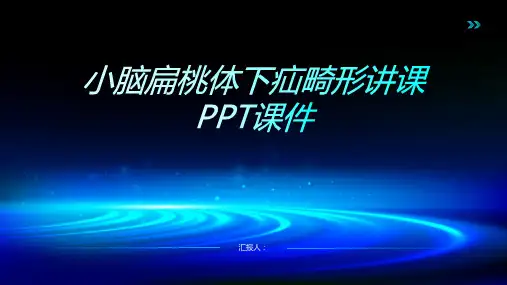小脑扁桃体下疝畸形讲课PPT课件