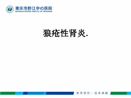 狼疮性肾炎.ppt课件
