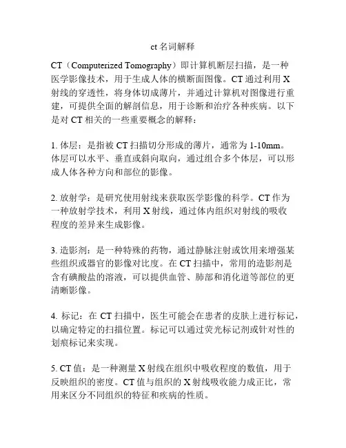 ct名词解释
