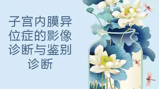 子宫内膜异位症的影像诊断与鉴别诊断