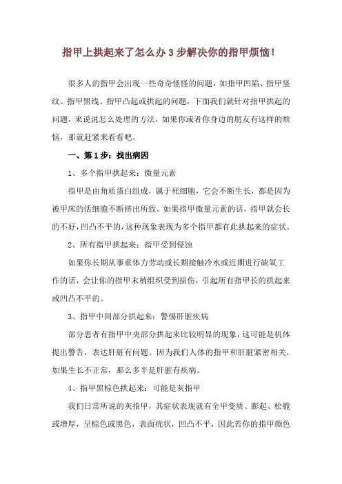 指甲上拱起来了怎么办 3步解决你的指甲烦恼!