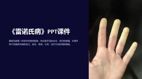 《雷诺氏病》课件