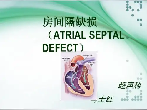 房间隔缺损PPTppt课件