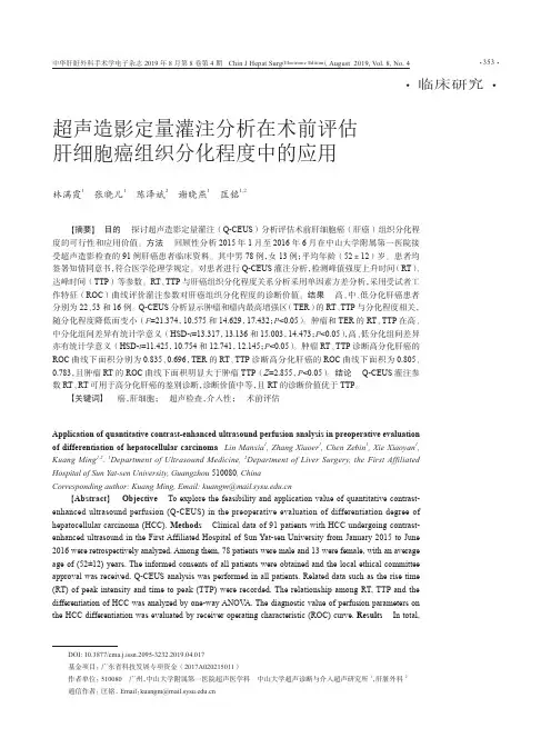 超声造影定量灌注分析在术前评估肝细胞癌组织分化程度中的应用