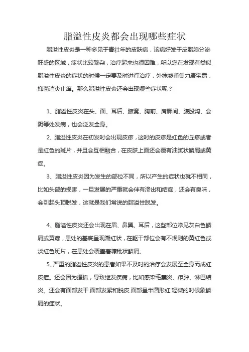 脂溢性皮炎都会出现哪些症状