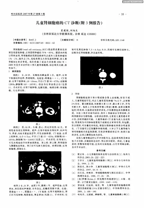 儿童肾细胞癌的CT诊断(附3例报告)