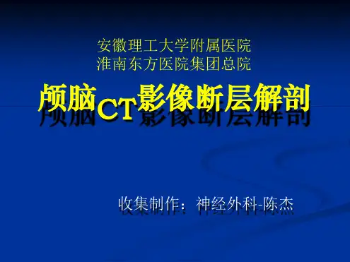 颅脑CT影像断层解剖