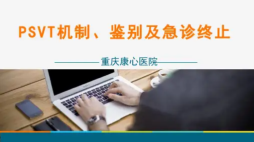 PSVT机制、鉴别及急诊终止