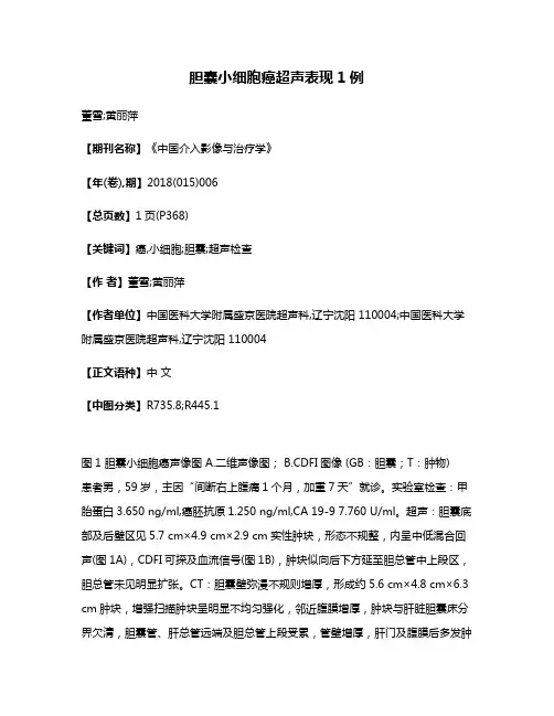 胆囊小细胞癌超声表现1例