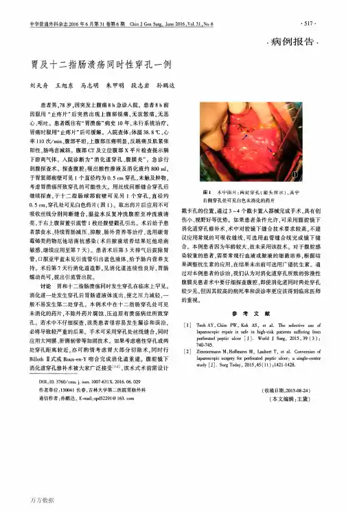 胃及十二指肠溃疡同时性穿孔一例论文