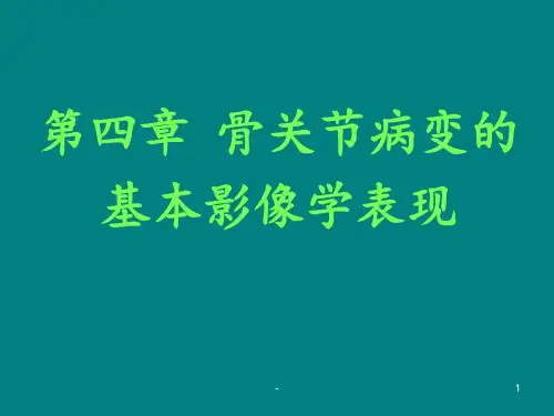 骨关节病变的基本影像学表现ppt课件