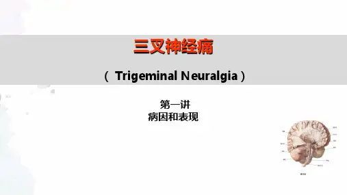 7 三叉神经痛(病因和表现)