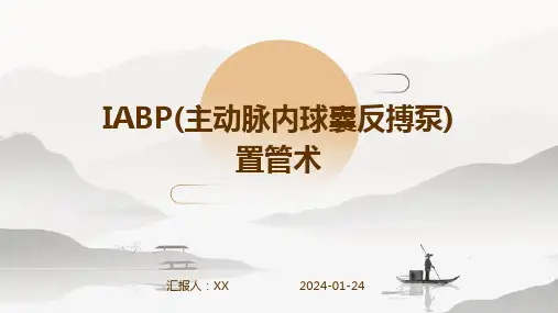 IABP(主动脉内球囊反搏泵)置管术