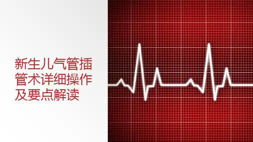 新生儿气管插管术详细操作及要点解读