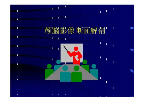 CTMR解剖