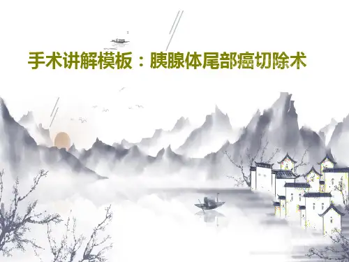 手术讲解模板：胰腺体尾部癌切除术共66页