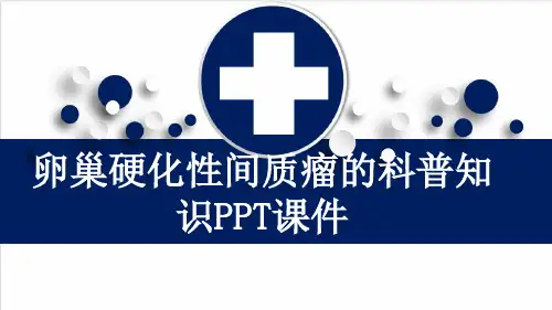 卵巢硬化性间质瘤的科普知识PPT课件