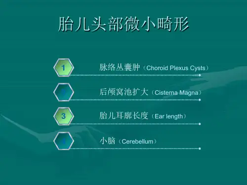 超声软指标的临床意义