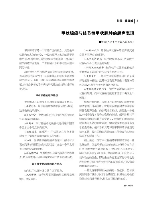 甲状腺癌与结节性甲状腺肿的超声表现