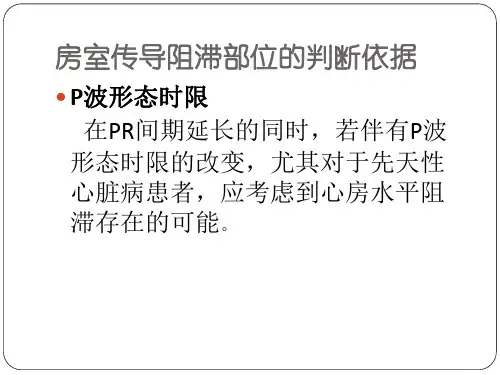 心电图判断房室传导阻滞部位-PPT文档